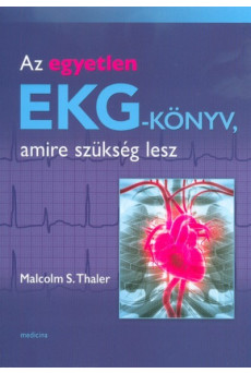 Az egyetlen EKG-könyv, amire szükség lesz